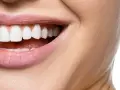 Hollywood Smile – co to jest i jak może odmienić twój uśmiech