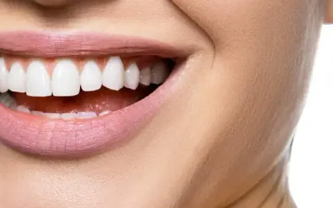 Hollywood Smile – co to jest i jak może odmienić twój uśmiech