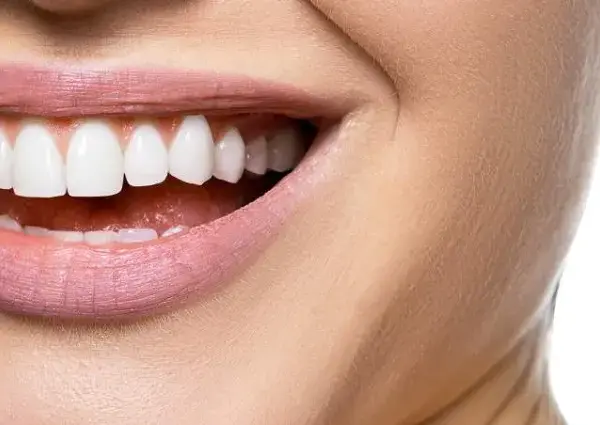 Hollywood Smile – co to jest i jak może odmienić twój uśmiech