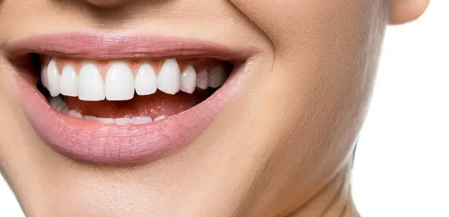 Hollywood Smile – co to jest i jak może odmienić twój uśmiech